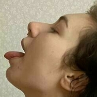 асид мелани Голи