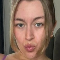 БейбиСи Голи