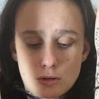 Басти Бъни Голи