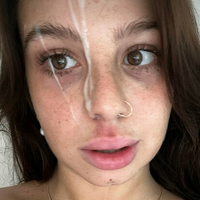 Фиталексис Голи