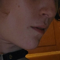 джинджъркитениксикс Голи