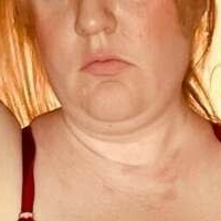 Хейзъл Айрис Голи