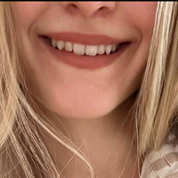 Хани Емс Голи