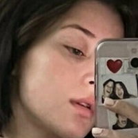 Ицселлексо Голи