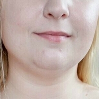 Джесрокс Голи