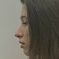 кеттиестетик Голи