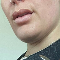 Скуиши Бей Голи