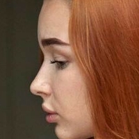 хбордерлайн Голи